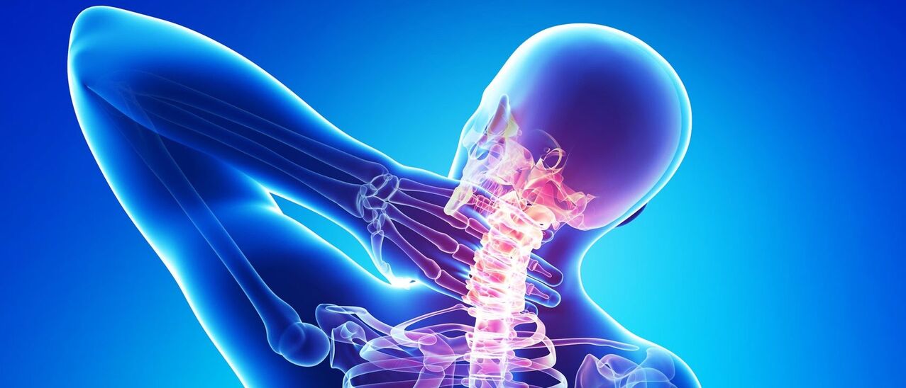 Osteochondrosis děložního čípku je patologický proces v oblasti páteře