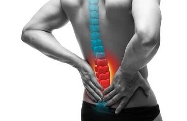 Osteochondróza je onemocnění páteře